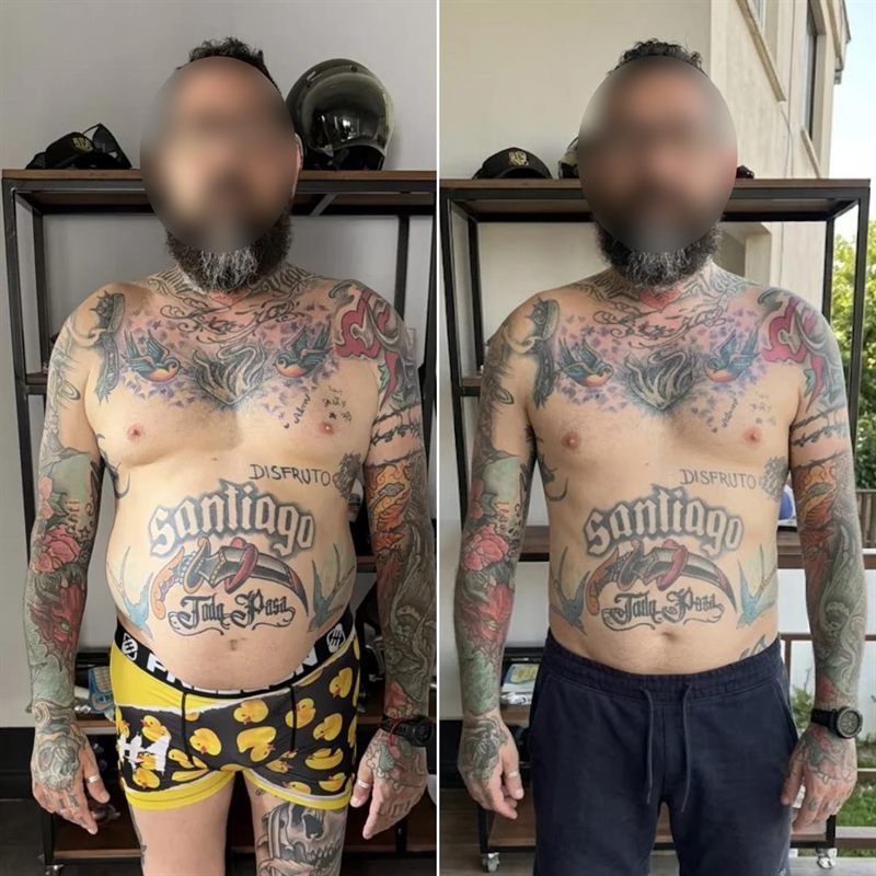 Antes y después de Franco F.