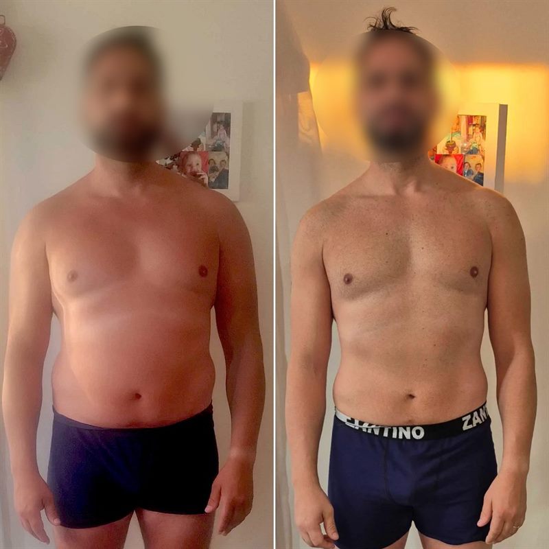 Antes y después de Ignacio F. (frente)