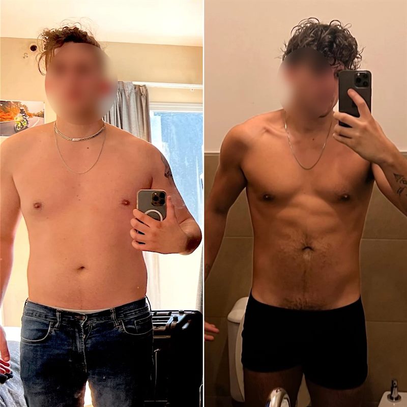 Antes y después de Ignacio V. (frente)