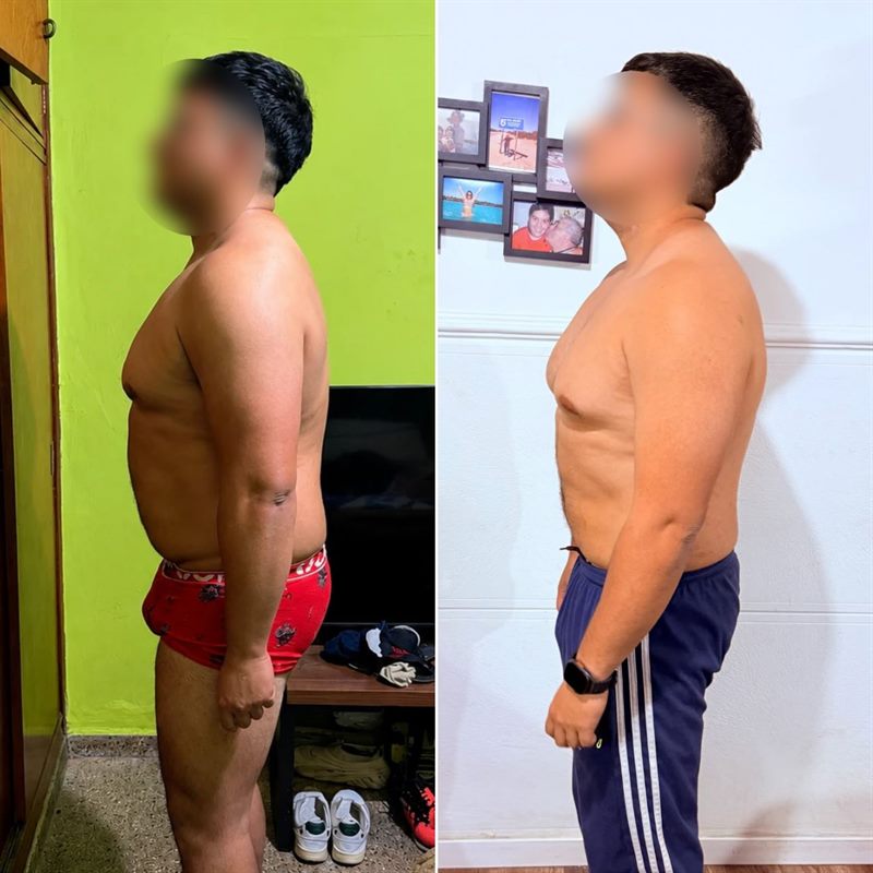 Antes y después de Lucio G. (lateral)